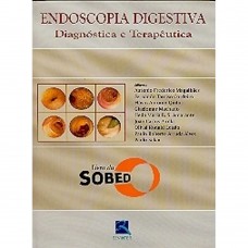ENDOSCOPIA DIGESTIVA DIAGNÓSTICA E TERAPÊUTICA 